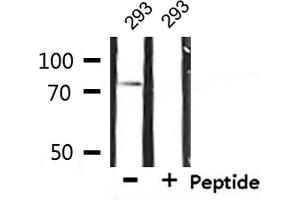 Western blot analysis of extracts from 293, using IL-2Rbeta/CD122 Antibody. (IL2 Receptor beta anticorps  (Internal Region))