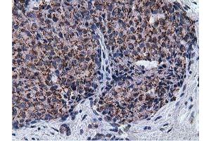 Immunohistochemical staining of paraffin-embedded Human liver tissue using anti-NT5DC1 mouse monoclonal antibody. (NT5DC1 anticorps)