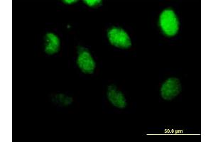 Immunofluorescence of purified MaxPab antibody to CSPG6 on HeLa cell. (SMC3 anticorps  (AA 1-1217))