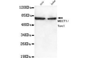 Western blot detection of MECT1 / Torc1 in Hela and Jurkat lysates using MECT1 / Torc1 mouse mAb (1:1000 diluted). (CRTC1 anticorps)