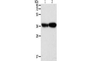 Western Blotting (WB) image for anti-Tropomyosin-2 (TPM2) antibody (ABIN2432365) (TPM2 anticorps)