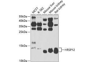 Western blot analysis of extracts of various cell lines, using HRSP12 antibody  at 1:1000 dilution. (HRSP12 anticorps  (AA 1-137))