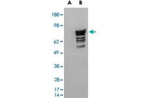 HEK293 overexpressing human PDE4D2 and probed with PDE4D polyclonal antibody  (mock transfection in first lane), tested by Origene. (PDE4D anticorps  (C-Term))