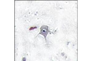 Image no. 1 for anti-Phosphoinositide 3 Kinase, p85 beta (PI3K p85b) (N-Term) antibody (ABIN360465) (PIK3R2 anticorps  (N-Term))