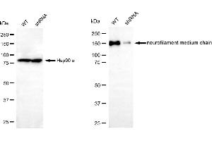 Western blotting analysis using neurofilament medium chain antibody (ABIN7799581). (NEFM anticorps)