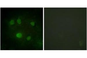 Immunofluorescence (IF) image for anti-DEAD (Asp-Glu-Ala-Asp) Box Polypeptide 5 (DDX5) (AA 565-614) antibody (ABIN2888821) (DDX5 anticorps  (AA 565-614))