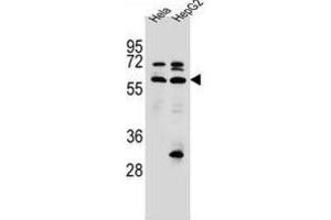Western Blotting (WB) image for anti-Selenoprotein N, 1 (SEPN1) antibody (ABIN2996755) (SEPN1 anticorps)