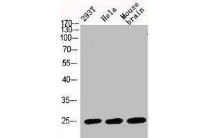 Western Blot analysis of 293T HELA MOUSE-BRAIN cells using Bak Polyclonal Antibody (BAK1 anticorps  (N-Term))