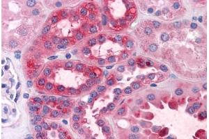 Human Kidney: Formalin-Fixed, Paraffin-Embedded (FFPE)