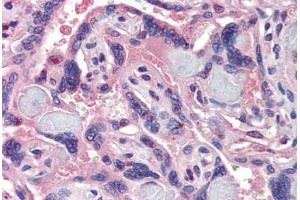 Placenta, Human: Formalin-Fixed, Paraffin-Embedded (FFPE)