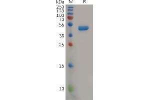 Human IL2 Protein, mFc Tag on SDS-PAGE under reducing condition.