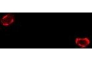 Immunofluorescent analysis of FIH-1 staining in U2OS cells.