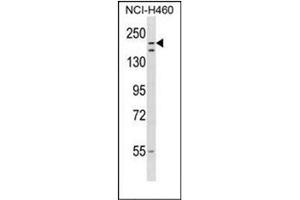 Western blot analysis of RNF160 Antibody  in NCI-H460 cell line lysates (35ug/lane). (RNF160 anticorps  (Middle Region))