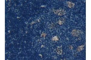 Detection of RANkL in Mouse Lymph node Tissue using Polyclonal Antibody to Receptor Activator Of Nuclear Factor Kappa B Ligand (RANkL)