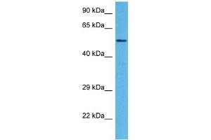 Host:  Rabbit  Target Name:  TRIM13  Sample Tissue:  Human DLD1 Whole Cell  Antibody Dilution:  1ug/ml