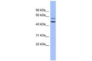 DKC1 antibody used at 1 ug/ml to detect target protein. (DKC1 anticorps  (N-Term))