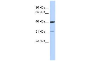 WB Suggested Anti-VSX1 Antibody Titration:  0. (VSX1 anticorps  (Middle Region))