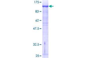 Image no. 1 for General Transcription Factor II I Repeat Domain-Containing 1 (GTF2IRD1) (AA 1-959) protein (GST tag) (ABIN1306160)