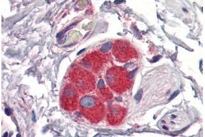Human Small Intestine, Submucosal Plexus: Formalin-Fixed, Paraffin-Embedded (FFPE)