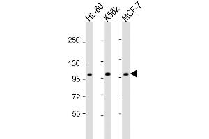 Western Blot at 1:2000 dilution Lane 1: HL-60 whole cell lysate Lane 2: K562 whole cell lysate Lane 3: MCF-7 whole cell lysate Lysates/proteins at 20 ug per lane.