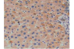 Figure. (SERPINA7 anticorps  (AA 128-415))