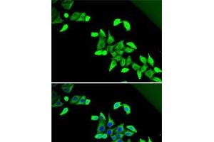 Immunofluorescence analysis of U2OS cells using CDKAL1 Polyclonal Antibody (CDKAL1 anticorps)