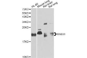 Western blot analysis of extracts of various cell lines, using RAB31 antibody (ABIN5995563) at 1/1000 dilution. (RAB31 anticorps)