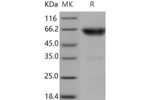 Western Blotting (WB) image for Tumor Necrosis Factor Receptor Superfamily, Member 1B (TNFRSF1B) (Active) protein (Fc Tag) (ABIN7320396)