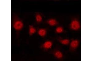 ABIN6267413 staining HepG2 by IF/ICC. (CEBPB anticorps  (pThr235))