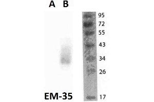 Western blotting analysis of FOLR2 in THP1 cells (A) and FOLR2-transfected THP1 cells (B) using anti-FOLR2 (EM-35) purified. (FOLR2 anticorps)