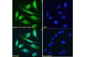ABIN184571 Immunofluorescence analysis of paraformaldehyde fixed HeLa cells, permeabilized with 0.