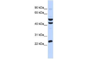WB Suggested Anti-ZNF200 Antibody Titration:  0. (ZNF200 anticorps  (Middle Region))