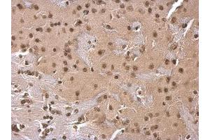 IHC Image SOD1 antibody detects SOD1 protein at cytosol on mouse fore brain by immunohistochemical analysis. (SOD1 anticorps)
