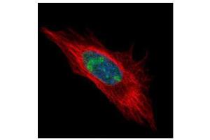 ICC/IF Image Confocal immunofluorescence analysis (Olympus FV10i) of paraformaldehyde-fixed HeLa, using DDX56, antibody (Green) at 1:500 dilution. (DDX56 anticorps  (Center))