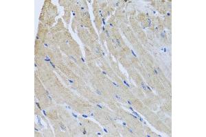 Immunohistochemistry of paraffin-embedded mouse heart using SRI antibody  at dilution of 1:100 (40x lens).