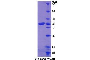 SDS-PAGE analysis of Mouse CORT Protein.