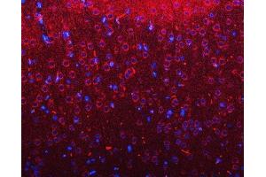 IF analysis of RIMBP2 using anti-RIMBP2 antibody (ABIN7601441). (RIMBP2 anticorps  (AA 351-1049))