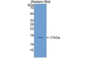 Detection of Recombinant RBP2, Human using Monoclonal Antibody to Retinol Binding Protein 2, Cellular (RBP2) (RBP2 anticorps  (AA 1-134))