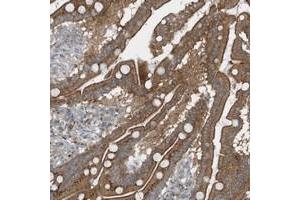 Immunohistochemical staining of human duodenum with GCC2 polyclonal antibody  shows moderate cytoplasmic and membranous positivity in glandular cells at 1:200-1:500 dilution. (GCC2 anticorps)