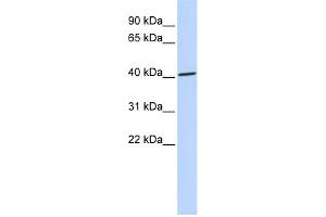 WB Suggested Anti-ZNF696 Antibody Titration:  0. (ZNF696 anticorps  (N-Term))