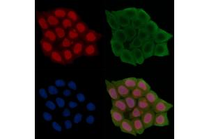 Phospho-MAP3K4 (Ser499) Antibody staining Hela cells(45 min of heat-shock treatment) by IF/ICC. (MAP3K4 anticorps  (pSer499))