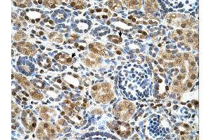 Immunohistochemistry (IHC) image for anti-Zinc Finger Protein 169 (ZNF169) (Middle Region) antibody (ABIN2783123)