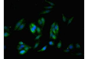 Immunofluorescent analysis of Hela cells using ABIN7171205 at dilution of 1:100 and Alexa Fluor 488-congugated AffiniPure Goat Anti-Rabbit IgG(H+L) (SYNM anticorps  (AA 1147-1417))