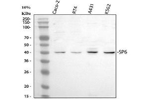 Western blot analysis of SP6 using anti-SP6 antibody (ABIN5692945). (SP6 anticorps)