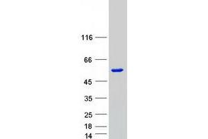 Validation with Western Blot