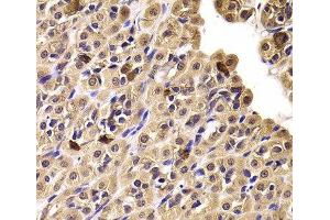 Immunohistochemistry of paraffin-embedded Rat stomach using CCT4 Polyclonal Antibody at dilution of 1:100 (40x lens). (CCT4 anticorps)