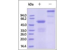 Human FGF-9, Fc Tag on SDS-PAGE under reducing (R) and no-reducing (NR) conditions. (FGF9 Protein (AA 4-208) (Fc Tag))