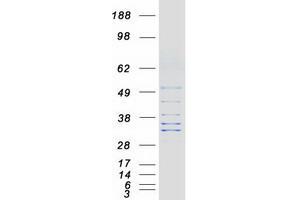 Validation with Western Blot