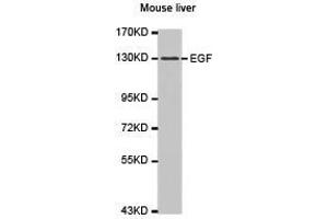 Western Blotting (WB) image for anti-Epidermal Growth Factor (EGF) antibody (ABIN1872450) (EGF anticorps)