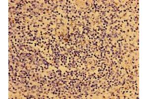 Immunohistochemistry of paraffin-embedded human spleen tissue using ABIN7149294 at dilution of 1:100